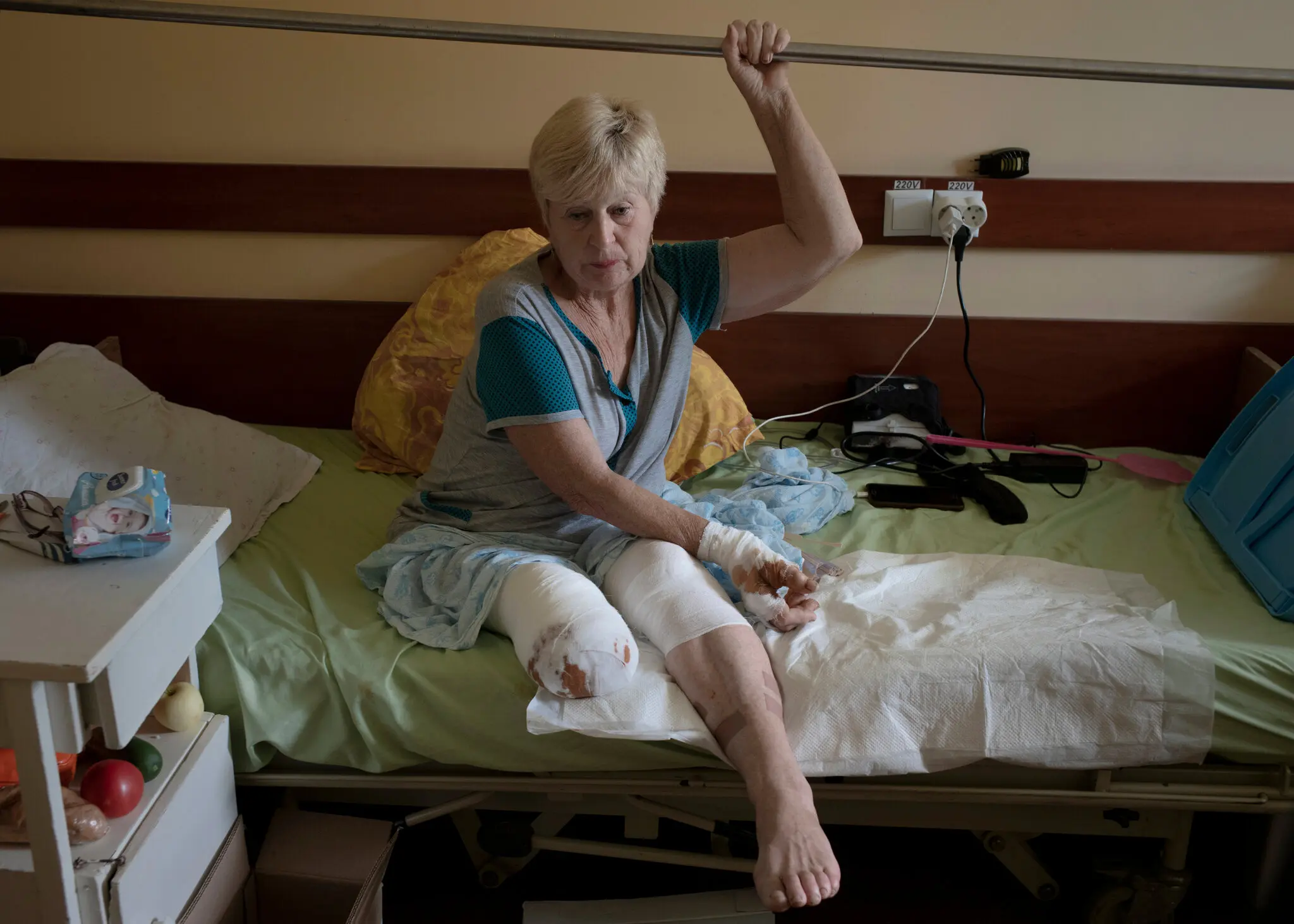 Лідія Борова в ізюмській лікарні, де перебуває на лікуванні після втрати правої ноги під час вибуху на міні. Вона налаштована знову навчитися ходити